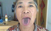 降血糖的中草藥有哪些 降血糖的中成藥有哪些