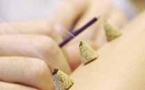 針灸多久做一次 針灸一次多長時間最好
