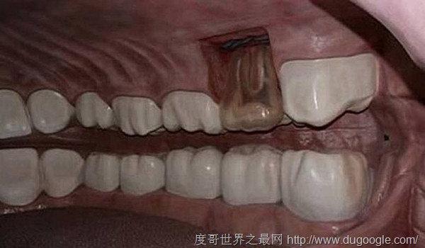 荷蘭建世界第一座人體博物館,可以走進人體大廈隨便逛