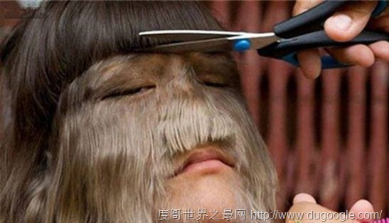 艾米麗&middot;蘇珊,世界上體毛最長的人