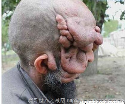 世界上最丑的男人，烏干達(dá)最丑男人取2個(gè)老婆生8個(gè)孩子