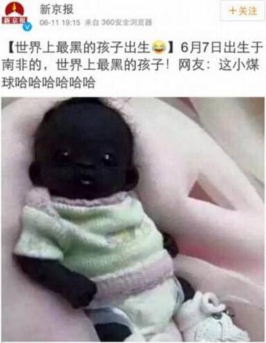 世界上最黑的孩子，黑出了人類的新高度(真實(shí)性